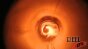 Alcohol 5inch Fire Tube1 400fps Image